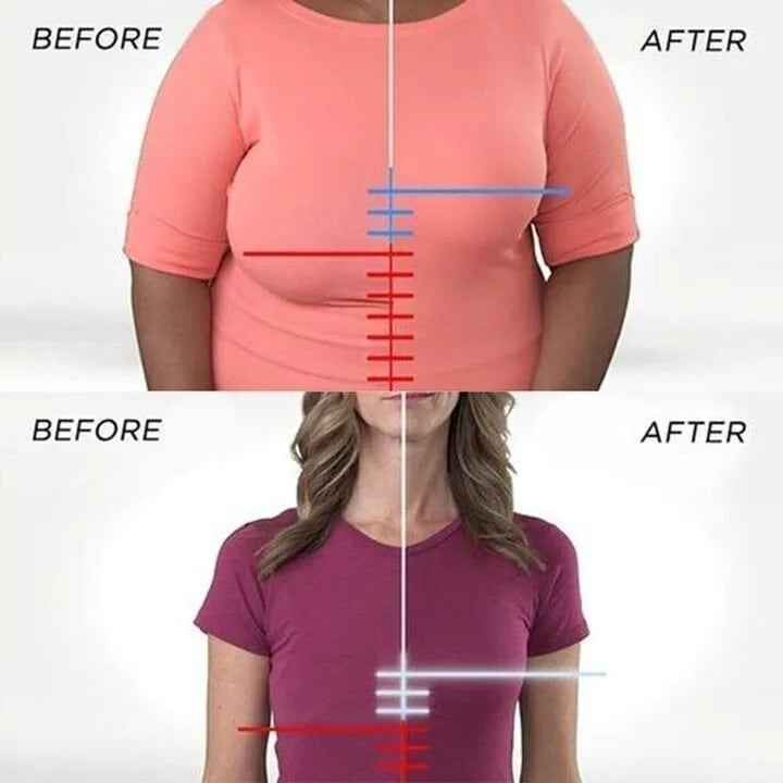 Lyro™ | SoftSupport Bra
